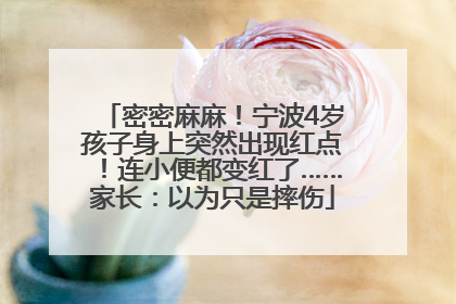密密麻麻！宁波4岁孩子身上突然出现红点！连小便都变红了……家长：以为只是摔伤